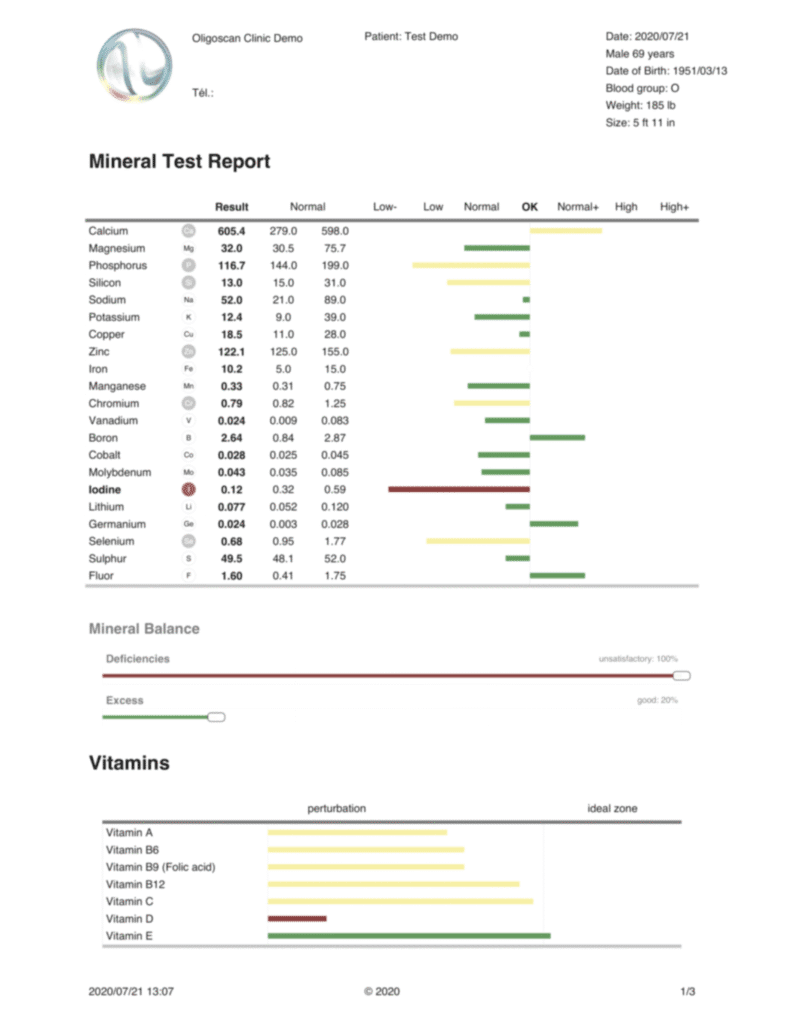 OligoScan mineral and heavy metal test report showing mineral balance results from a palm scan in Aiken SC